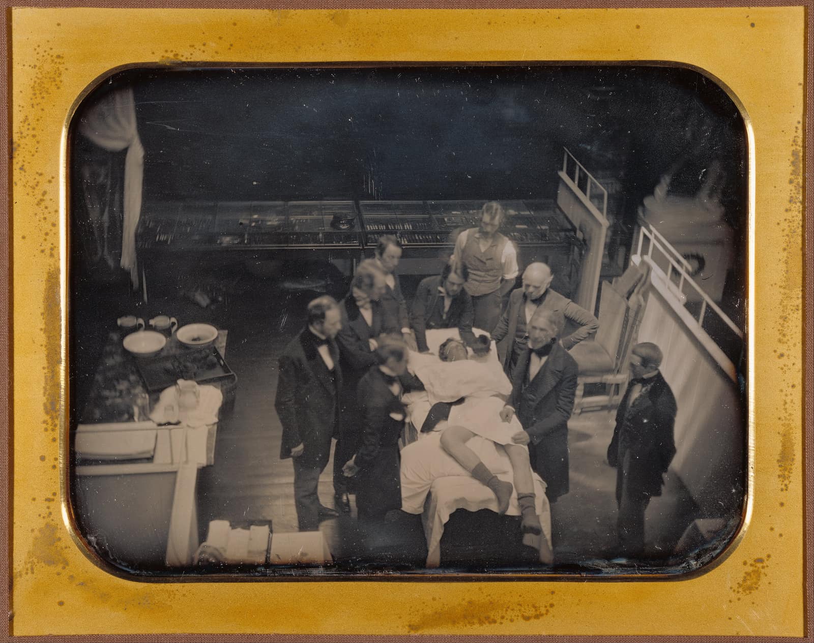 Un daguerréotype argenté dans un passe-partout de laiton doré aux angles arrondis, vu d'en haut. Dans une salle d'opération dépouillée, un patient est allongé sur une table sous des draps blancs, les jambes nues dans des chaussettes sombres. Une dizaine d'hommes en redingote sombre l'entourent ; l'un tient une éponge près de son visage, et un homme âgé pose les mains sur la cuisse du patient. Leurs têtes sont floues à cause de la longue pose. Derrière eux, des vitrines d'instruments ; à gauche, une desserte avec des bassines et du linge plié.